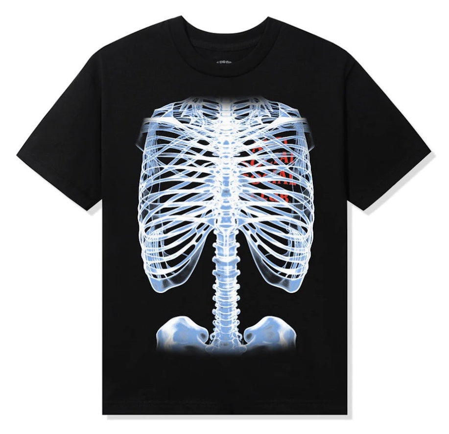 Anti Social Social Club Bones Tee Black