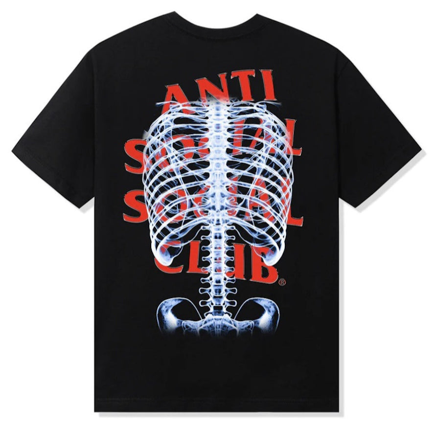 Anti Social Social Club Bones Tee Black